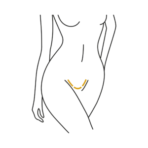Woman's body illustration highlighting the location of the Vaginoplasty